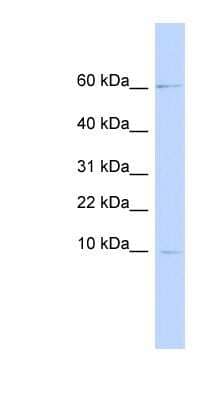 Western Blot: Trappin-2/Elafin/Skalp Antibody [NBP1-62538]