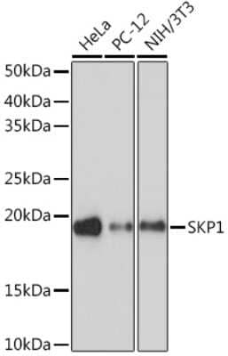 Western Blot: Skp1 Antibody (10G5X5) [NBP3-16734]