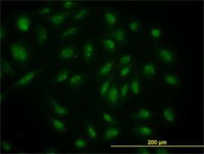 Immunocytochemistry/ Immunofluorescence: Skp1 Antibody (1H8) [H00006500-M01]