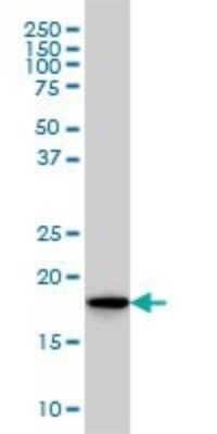 Western Blot: Skp1 Antibody (1H8) [H00006500-M01]