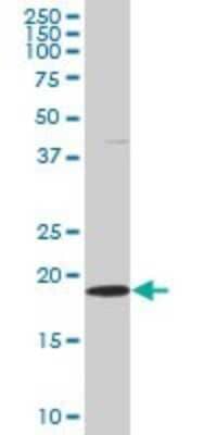 Western Blot: Skp1 Antibody (2E6) [H00006500-M03]