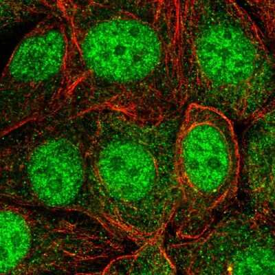 Immunocytochemistry/ Immunofluorescence: Skp1 Antibody [NBP2-58725]