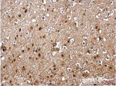 Immunohistochemistry-Paraffin: Skp1 Antibody [NBP2-20380]