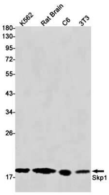 Western Blot: Skp1 Antibody (S01-6H2) [NBP3-14975]