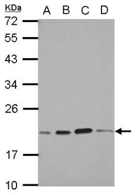 Western Blot: Skp1 Antibody [NBP2-20380]