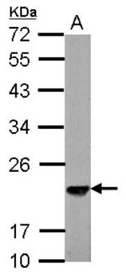 Western Blot: Skp1 Antibody [NBP2-20380]