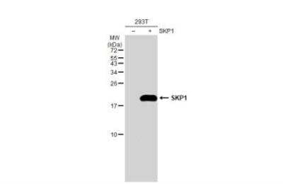 Western Blot: Skp1 Antibody [NBP2-20381]