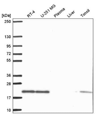 Western Blot: Skp1 Antibody [NBP2-56707]