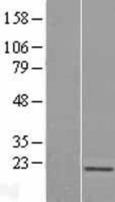 Western Blot: Skp1 Overexpression Lysate [NBL1-15994]