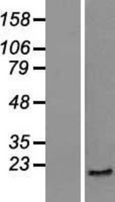 Western Blot: Skp1 Overexpression Lysate [NBP2-09837]