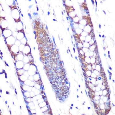 Immunohistochemistry-Paraffin: Skp2 Antibody (2L0K1) [NBP3-16320]