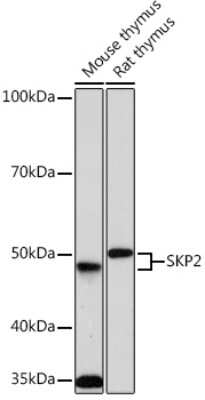 Western Blot: Skp2 Antibody (2L0K1) [NBP3-16320]