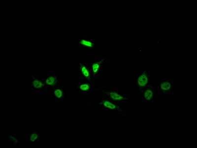 Immunocytochemistry/ Immunofluorescence: Skp2 Antibody (3C11) [NBP3-15197]