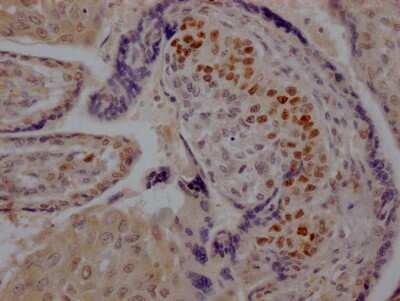 Immunohistochemistry: Skp2 Antibody (6D4) [NBP3-15203]