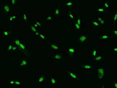 Immunocytochemistry/ Immunofluorescence: Skp2 Antibody [NBP2-97674]