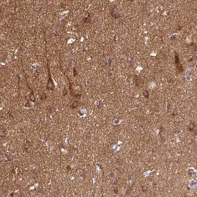 Immunohistochemistry-Paraffin: Skp2 Antibody [NBP2-49142]
