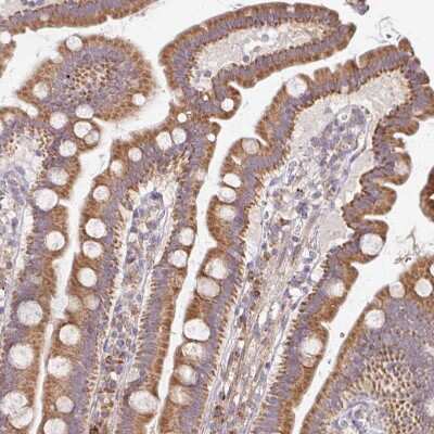Immunohistochemistry-Paraffin: Skp2 Antibody [NBP2-49142]