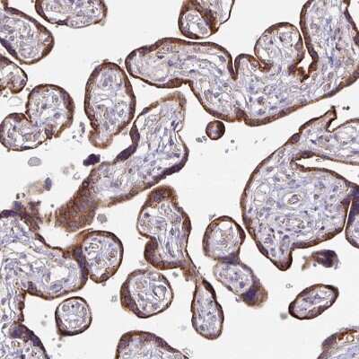 Immunohistochemistry-Paraffin: Skp2 Antibody [NBP2-49142]