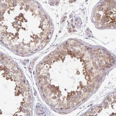 Immunohistochemistry-Paraffin: Skp2 Antibody [NBP2-49142]