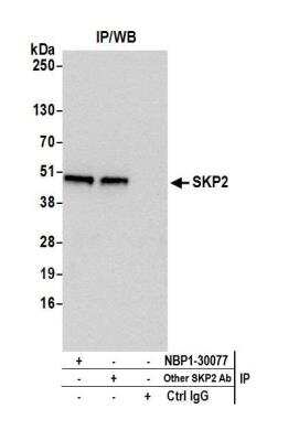 Immunoprecipitation: Skp2 Antibody [NBP1-30077]