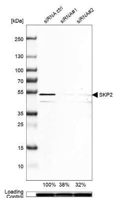 Western Blot: Skp2 Antibody [NBP2-49142]