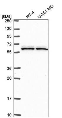 Western Blot: Skp2 Antibody [NBP2-56192]