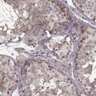 Immunohistochemistry-Paraffin: Slain2 Antibody [NBP2-57345]