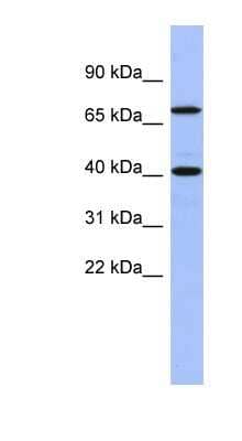 Western Blot: Slain2 Antibody [NBP1-55242]