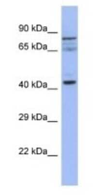 Western Blot: Slain2 Antibody [NBP3-09376]