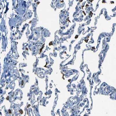 Immunohistochemistry-Paraffin: Slap Antibody [NBP1-80744]