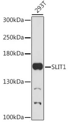 Western Blot: Slit1 AntibodyAzide and BSA Free [NBP2-95180]