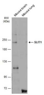 Western Blot: Slit1 Antibody [NBP3-13365]