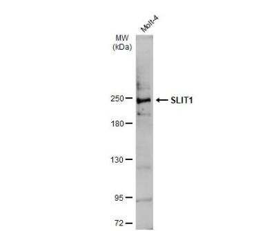 Western Blot: Slit1 Antibody [NBP3-13365]