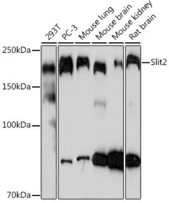 Western Blot: Slit2 Antibody (1T5A3) [NBP3-16194]