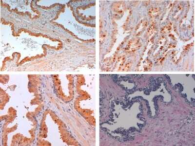 Immunohistochemistry: Slit2 Antibody [NB600-881]