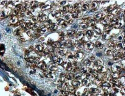 Immunohistochemistry-Paraffin: Slit2 Antibody [NB100-40807]