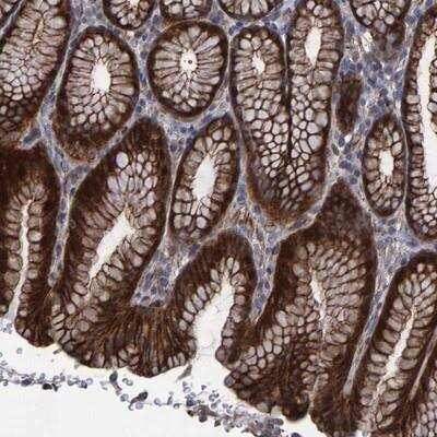 Immunohistochemistry-Paraffin: Slit2 Antibody [NBP1-80742]