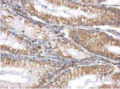 Immunohistochemistry-Paraffin: Slit2 Antibody [NBP2-20398]