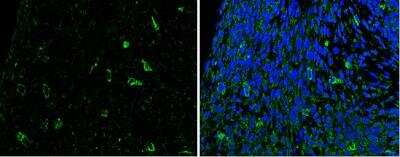 Immunohistochemistry-Paraffin: Slit2 Antibody [NBP2-20398]