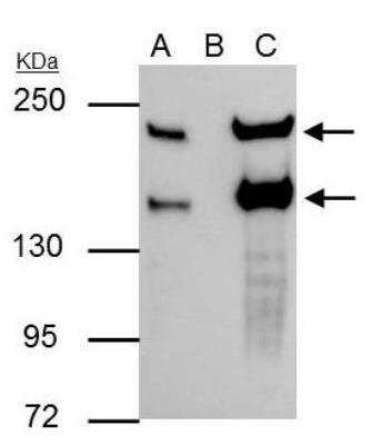 Immunoprecipitation: Slit2 Antibody [NBP2-20398]