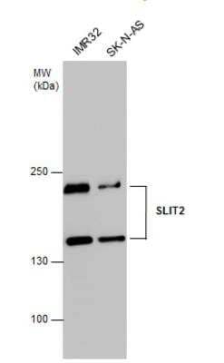 Western Blot: Slit2 Antibody [NBP2-20398]