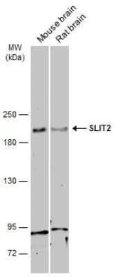 Western Blot: Slit2 Antibody [NBP2-20398]