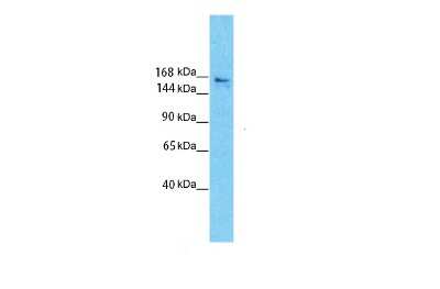 Western Blot: Slit3 Antibody [NBP1-59140]