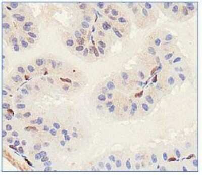 Immunohistochemistry: SLITRK1 Antibody - BSA Free [NBP1-49541]