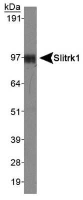 Western Blot: SLITRK1 AntibodyBSA Free [NBP1-49541]