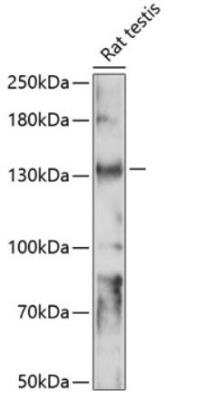Western Blot: Slo3 AntibodyAzide and BSA Free [NBP3-05611]