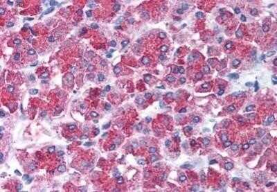 Immunohistochemistry-Paraffin: Slug Antibody - BSA Free [NB100-80828]