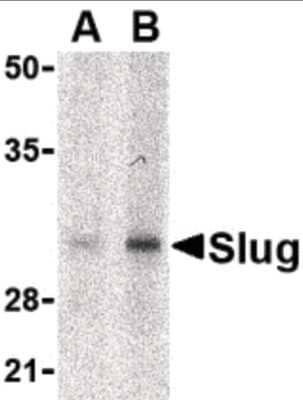 Western Blot: Slug AntibodyBSA Free [NB100-80828]