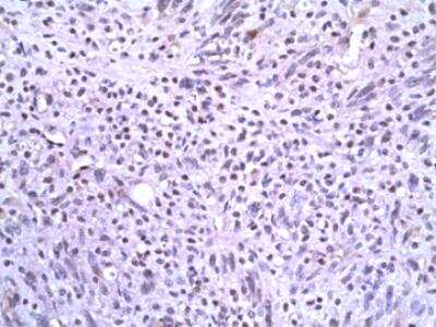 Immunohistochemistry-Paraffin: Slug Antibody (OTI1A6) [NBP2-03886]