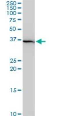 Western Blot: Slug Antibody (3C12) [H00006591-M05]